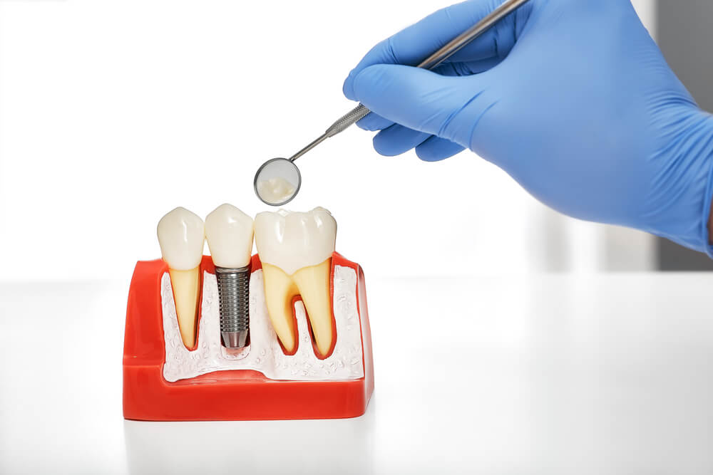 Different types of oral surgery | Dr Jaclyn Wong, Malvern, Victoria