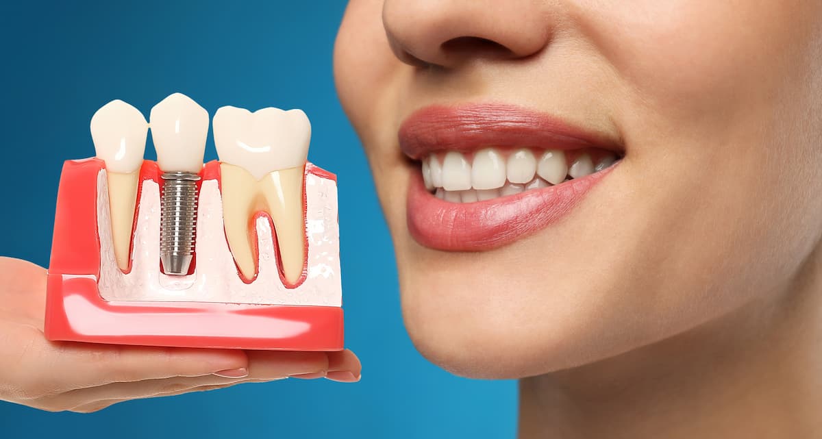 Restore Your Smile with Dental Implants: Professional Care from Dr Jaclyn Wong