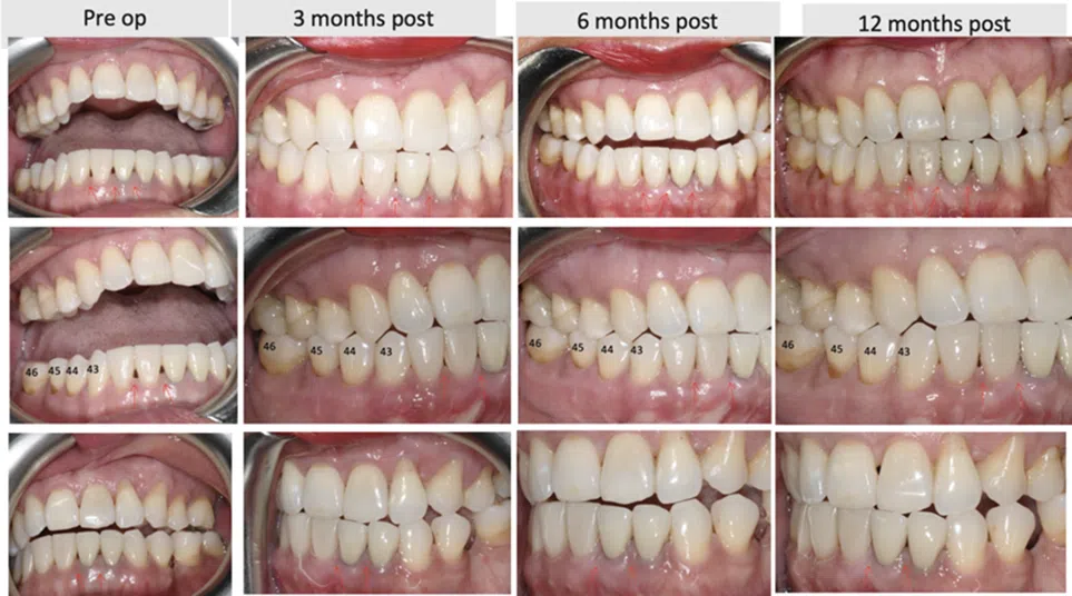 Cases By Dr Wong