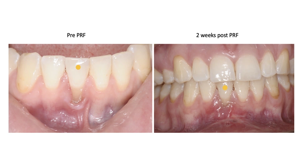 Cases By Dr Wong - 1