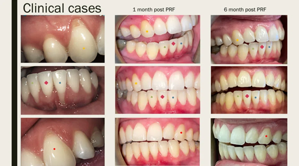 Cases By Dr Wong - 2