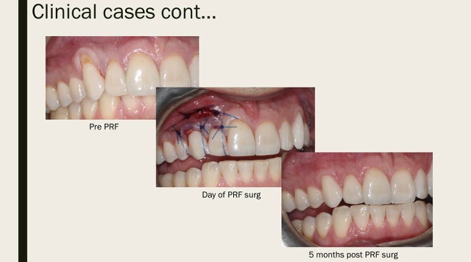 Cases By Dr Wong - 3